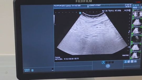 Głogów: rusza kolejna edycja programu „Stop nowotworom u dzieci i młodzieży”