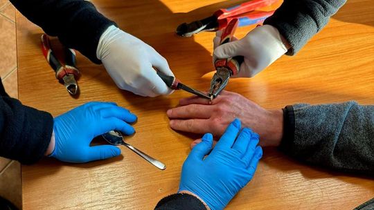 Nietypowa interwencja strażaków. Pomagali zdjąć obrączkę