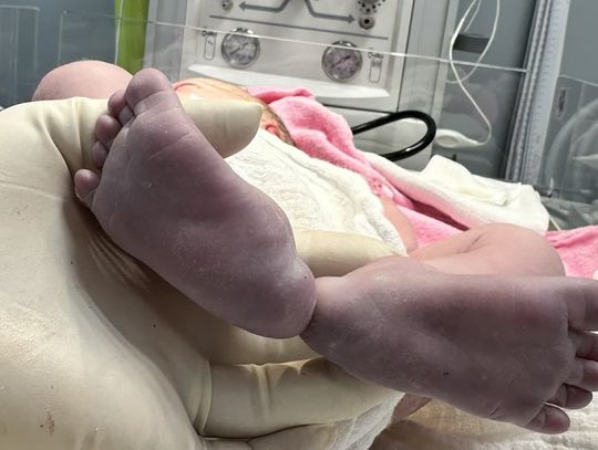 Marzec na porodówce w Głogowie. Ilu chłopców, ile dziewczynek? Marzec na porodówce w Głogowie. Ilu chłopców, ile dziewczynek?