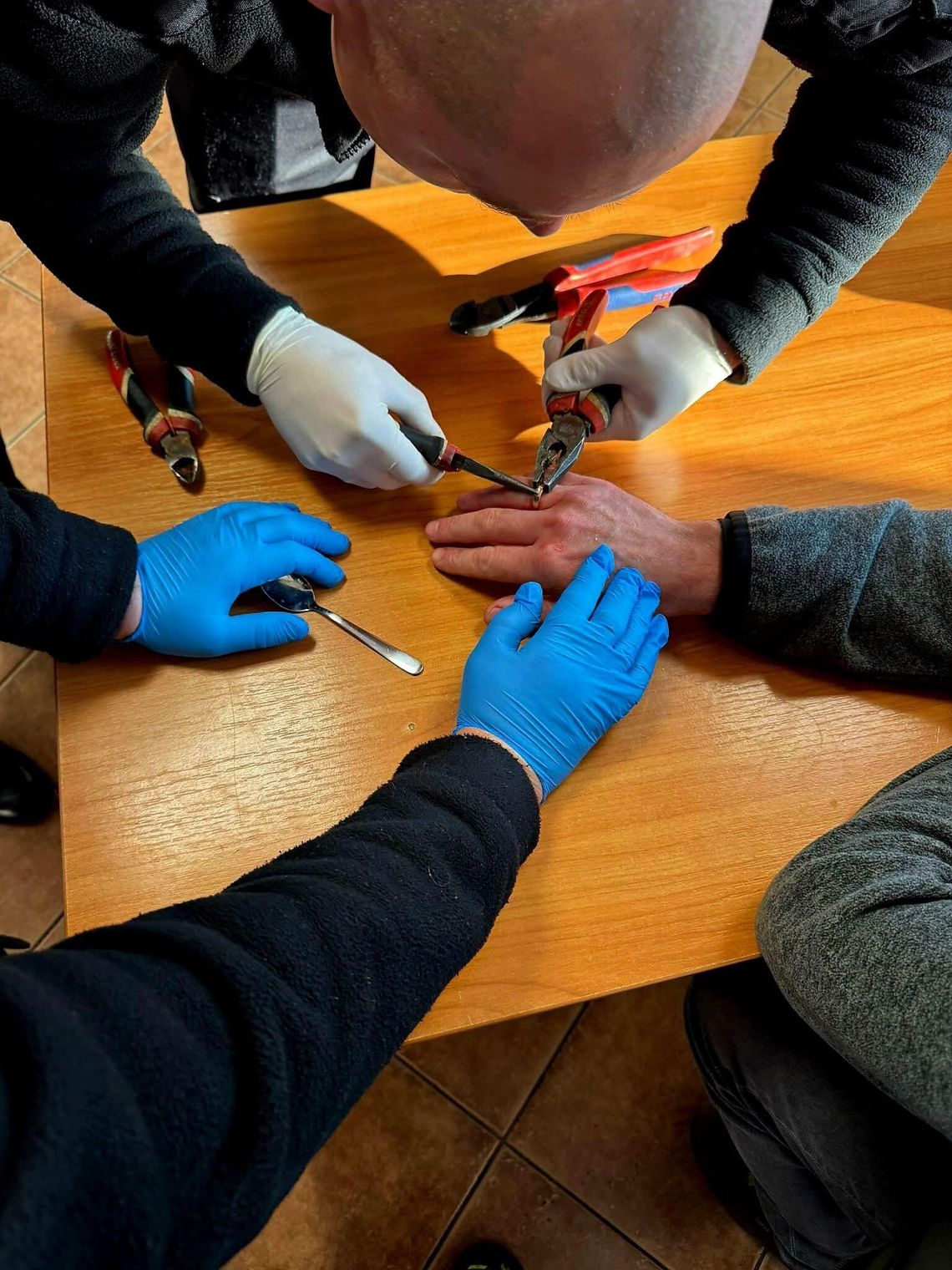 Nietypowa interwencja strażaków. Pomagali zdjąć obrączkę